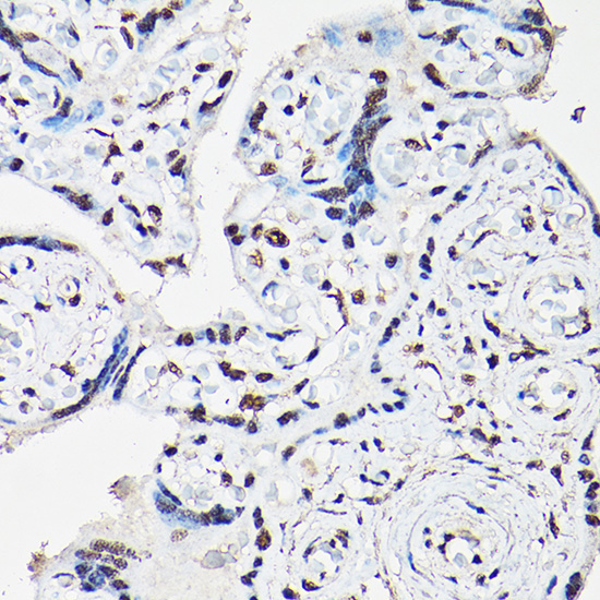 FOXO1/FOXO3A/FOXO4 Rabbit Polyclonal Antibody - Image 2
