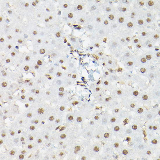 FOXO1/FOXO3A/FOXO4 Rabbit Polyclonal Antibody - Image 3