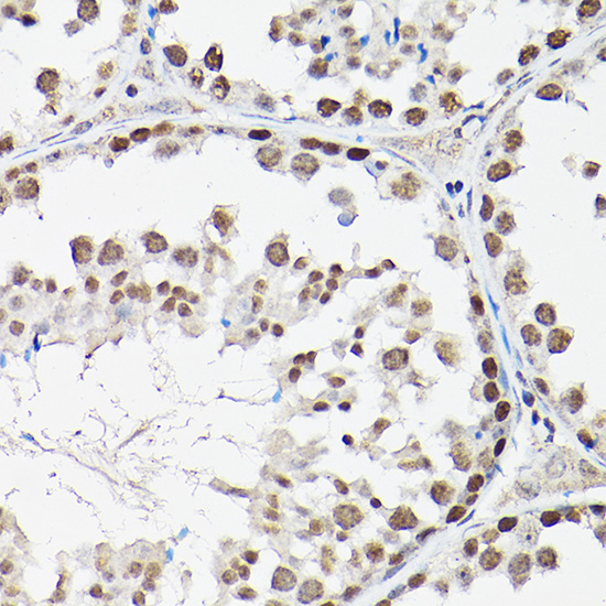 FOXO1/FOXO3A/FOXO4 Rabbit Polyclonal Antibody - Image 4