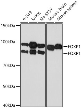 FOXP1 Rabbit Monoclonal Antibody