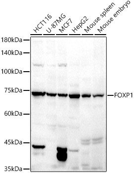 FOXP1 Rabbit Polyclonal Antibody