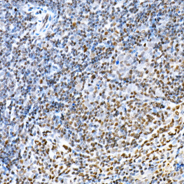 FOXP1 Rabbit Polyclonal Antibody - Image 2