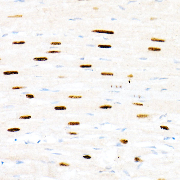 FOXP1 Rabbit Polyclonal Antibody - Image 3