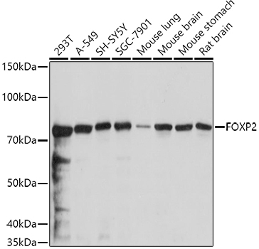 FOXP2 Rabbit Polyclonal Antibody