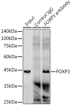 FOXP3 Rabbit Monoclonal Antibody - Image 2
