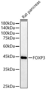 FOXP3 Rabbit Polyclonal Antibody