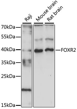 FOXR2 Rabbit Polyclonal Antibody