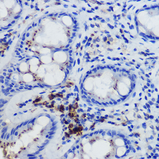 FPR1 Rabbit Polyclonal Antibody