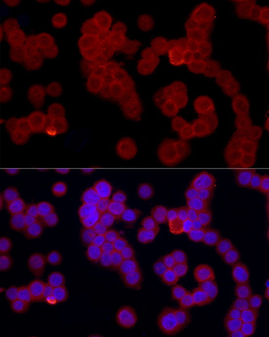 FPR2 Rabbit Polyclonal Antibody