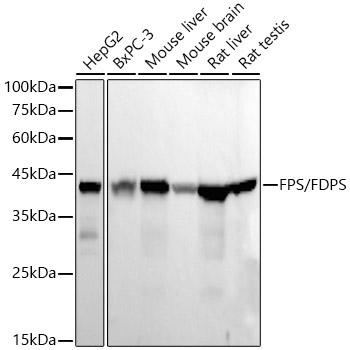 FPS/FDPS Rabbit Monoclonal Antibody