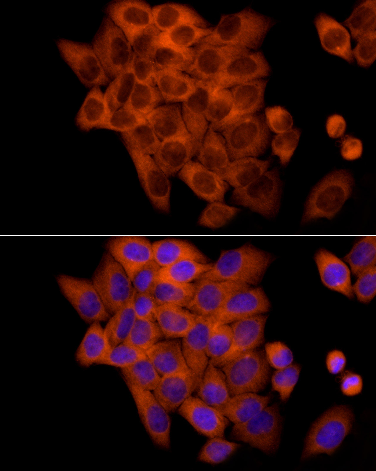 FRAT1 Rabbit Monoclonal Antibody
