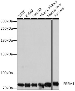 FREM1 Rabbit Polyclonal Antibody