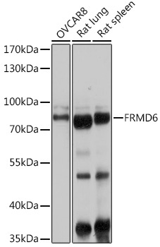 FRMD6 Rabbit Polyclonal Antibody - Image 2
