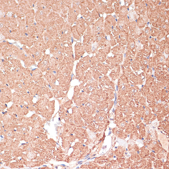 FRMD6 Rabbit Polyclonal Antibody - Image 3