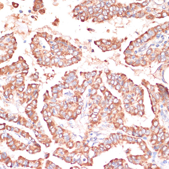FRMD6 Rabbit Polyclonal Antibody - Image 4