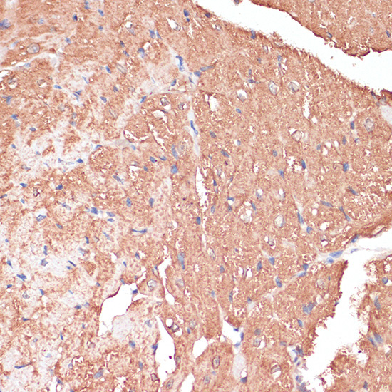 FRMD6 Rabbit Polyclonal Antibody - Image 5