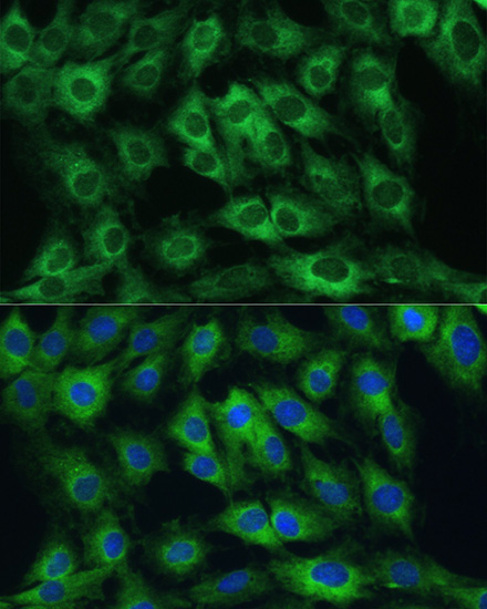 FRMD6 Rabbit Polyclonal Antibody - Image 6