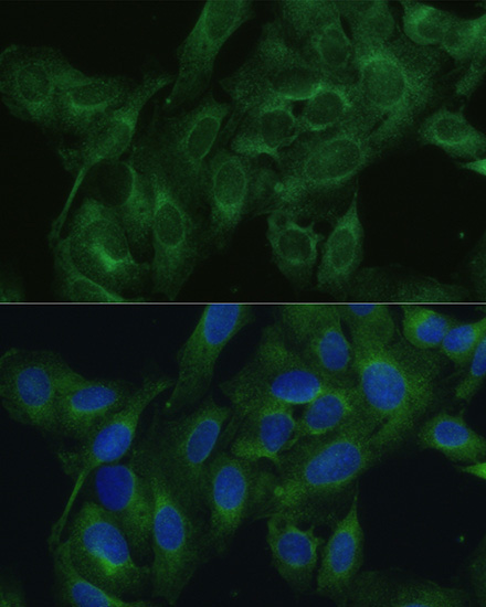 FRMD6 Rabbit Polyclonal Antibody - Image 7