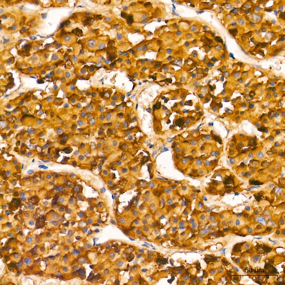 FSH alpha/beta Rabbit Monoclonal Antibody