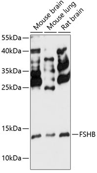 FSHB Rabbit Polyclonal Antibody