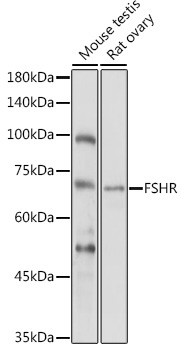 FSHR Rabbit Polyclonal Antibody - Image 2