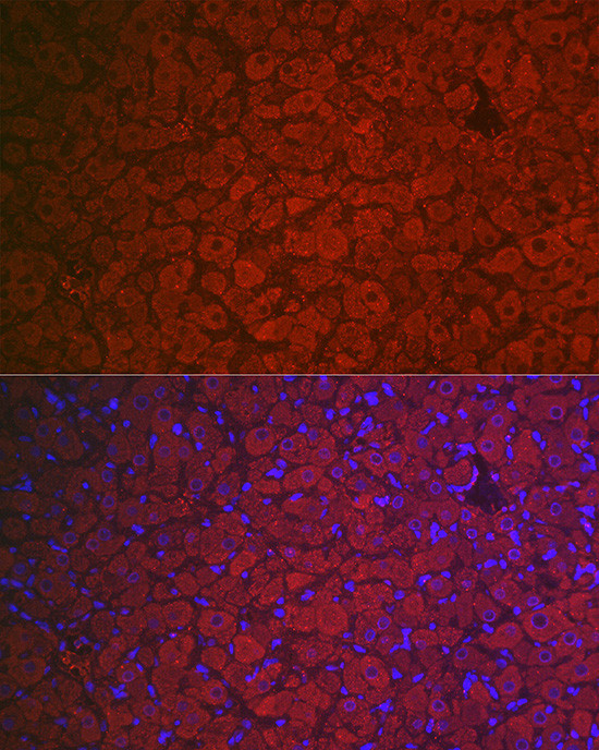 FSHR Rabbit Polyclonal Antibody - Image 3