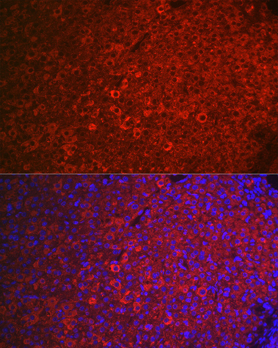 FSHR Rabbit Polyclonal Antibody - Image 4