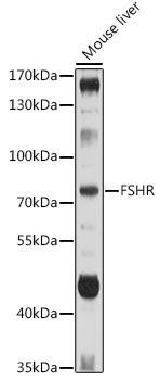 FSHR Rabbit Polyclonal Antibody