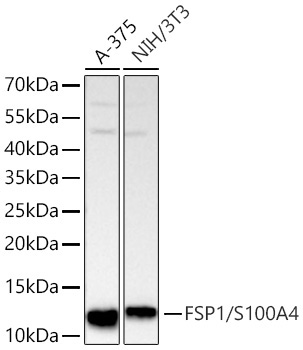 FSP1/S100A4 Rabbit Monoclonal Antibody