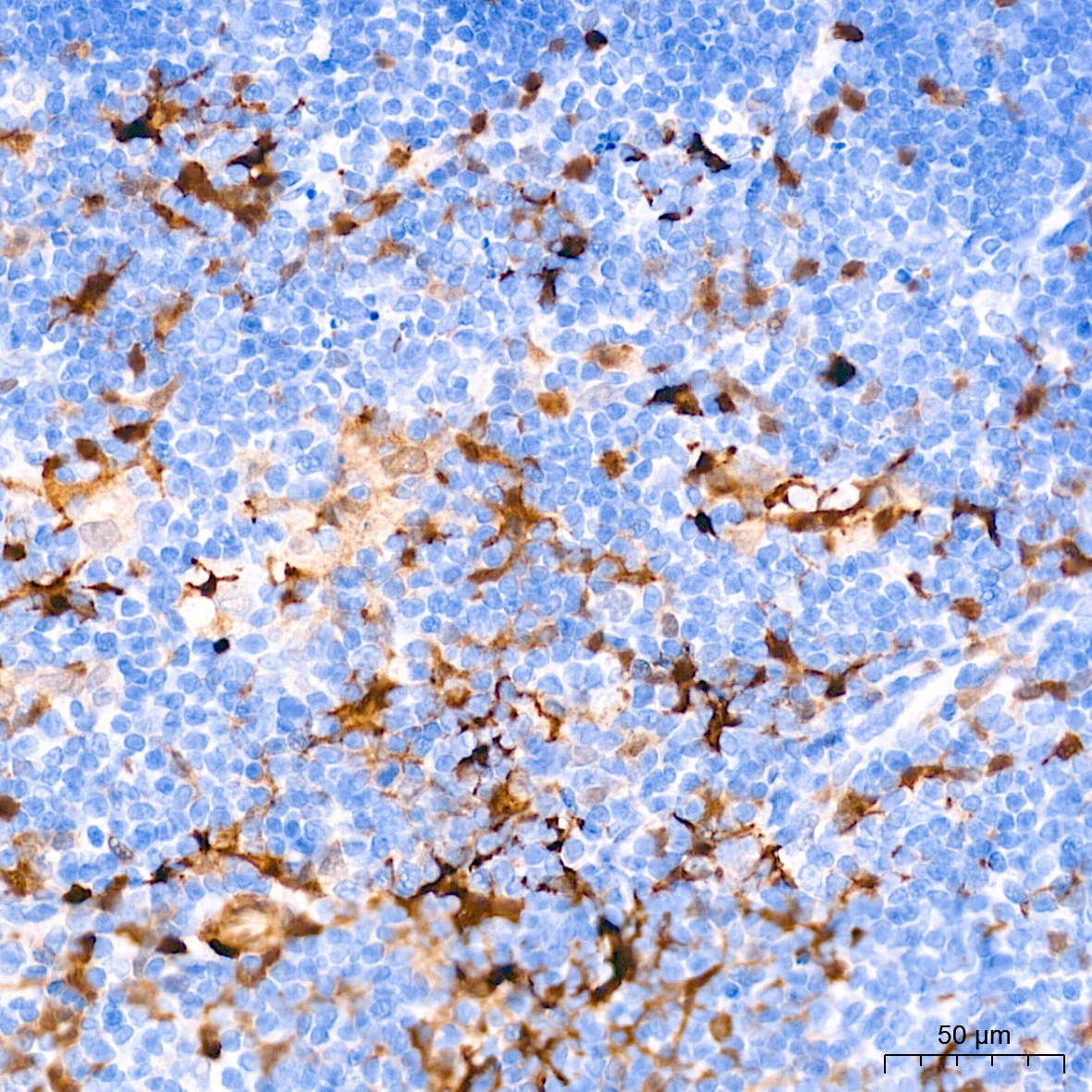 FSP1/S100A4 Rabbit Monoclonal Antibody - Image 10