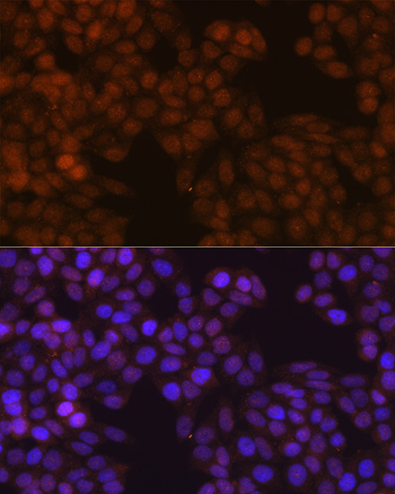 FSP1/S100A4 Rabbit Monoclonal Antibody - Image 11