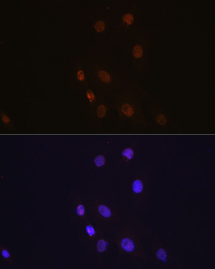 FSP1/S100A4 Rabbit Monoclonal Antibody - Image 12