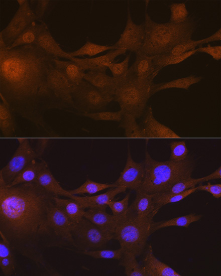 FSP1/S100A4 Rabbit Monoclonal Antibody - Image 13
