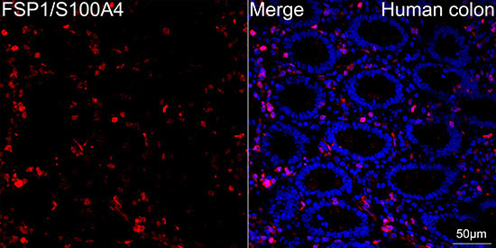 FSP1/S100A4 Rabbit Monoclonal Antibody - Image 14