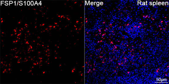 FSP1/S100A4 Rabbit Monoclonal Antibody - Image 15