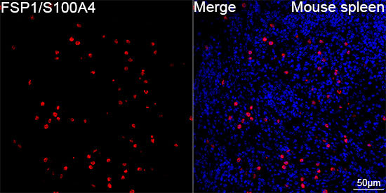 FSP1/S100A4 Rabbit Monoclonal Antibody - Image 16
