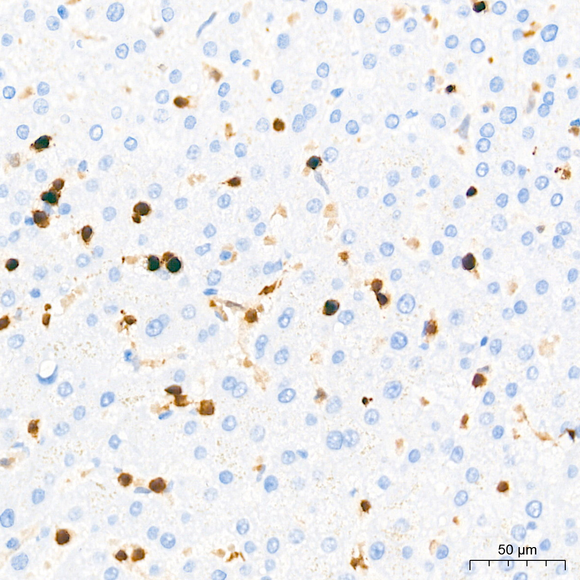 FSP1/S100A4 Rabbit Monoclonal Antibody - Image 2