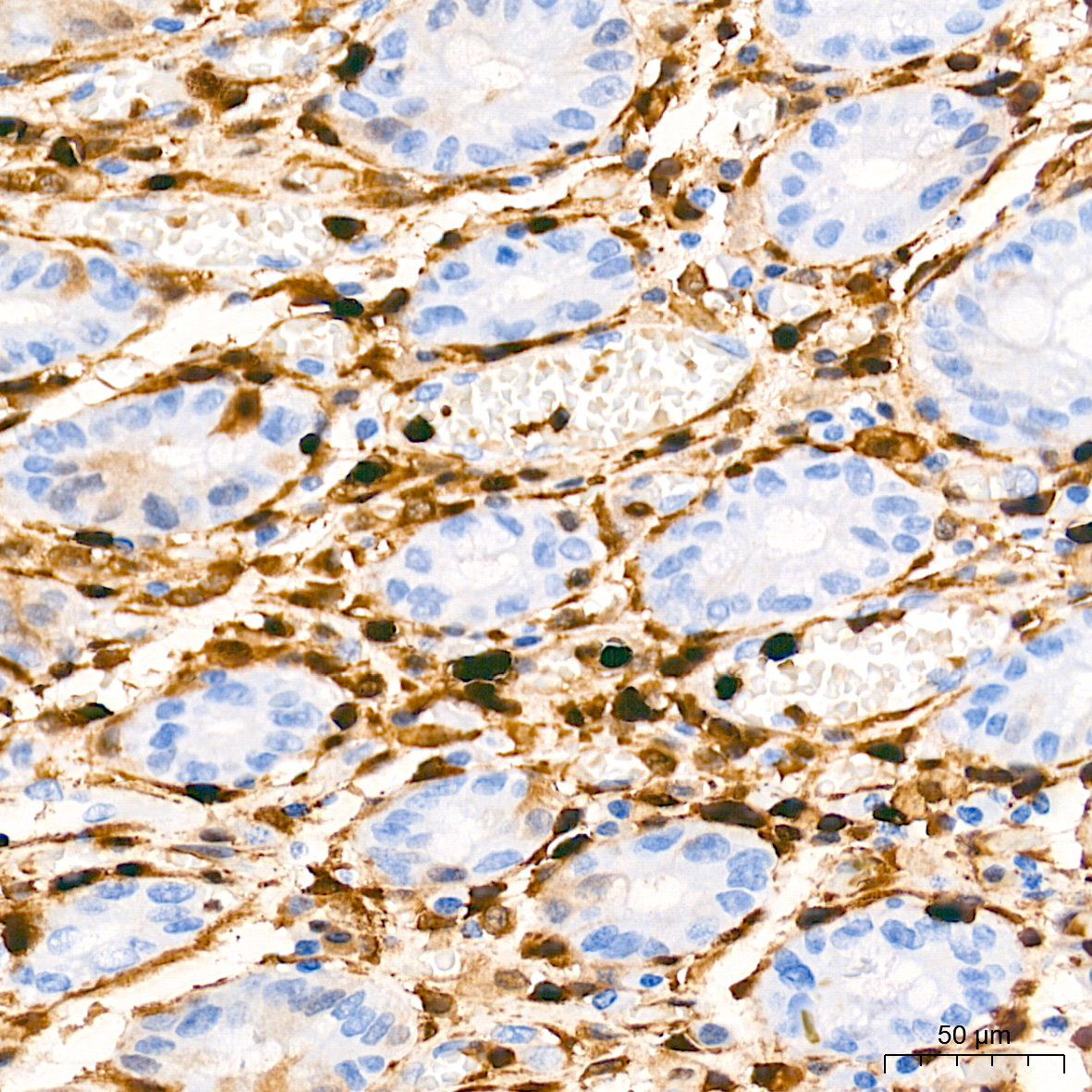 FSP1/S100A4 Rabbit Monoclonal Antibody - Image 3