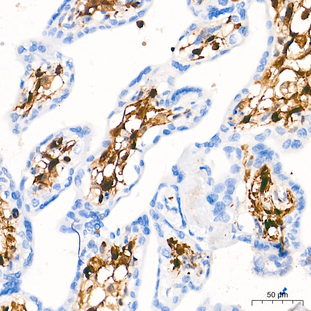 FSP1/S100A4 Rabbit Monoclonal Antibody - Image 4