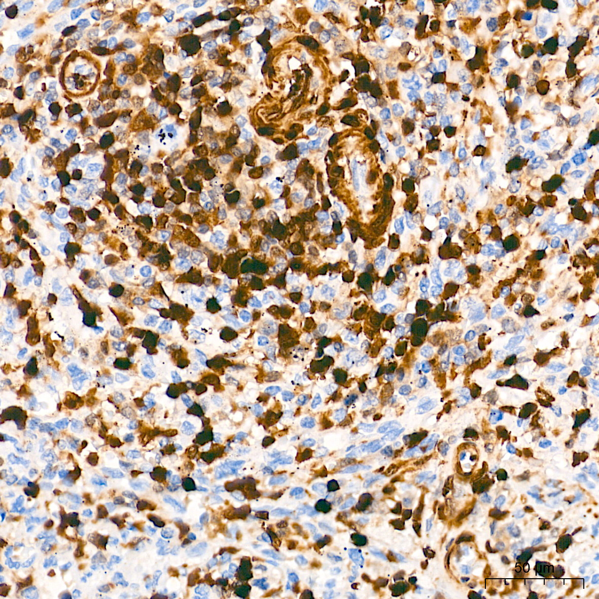 FSP1/S100A4 Rabbit Monoclonal Antibody - Image 5