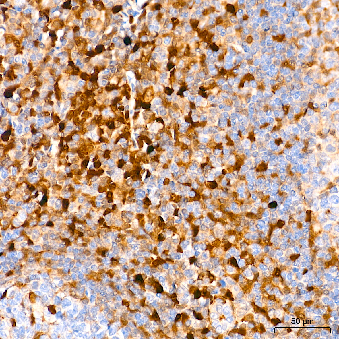 FSP1/S100A4 Rabbit Monoclonal Antibody - Image 6