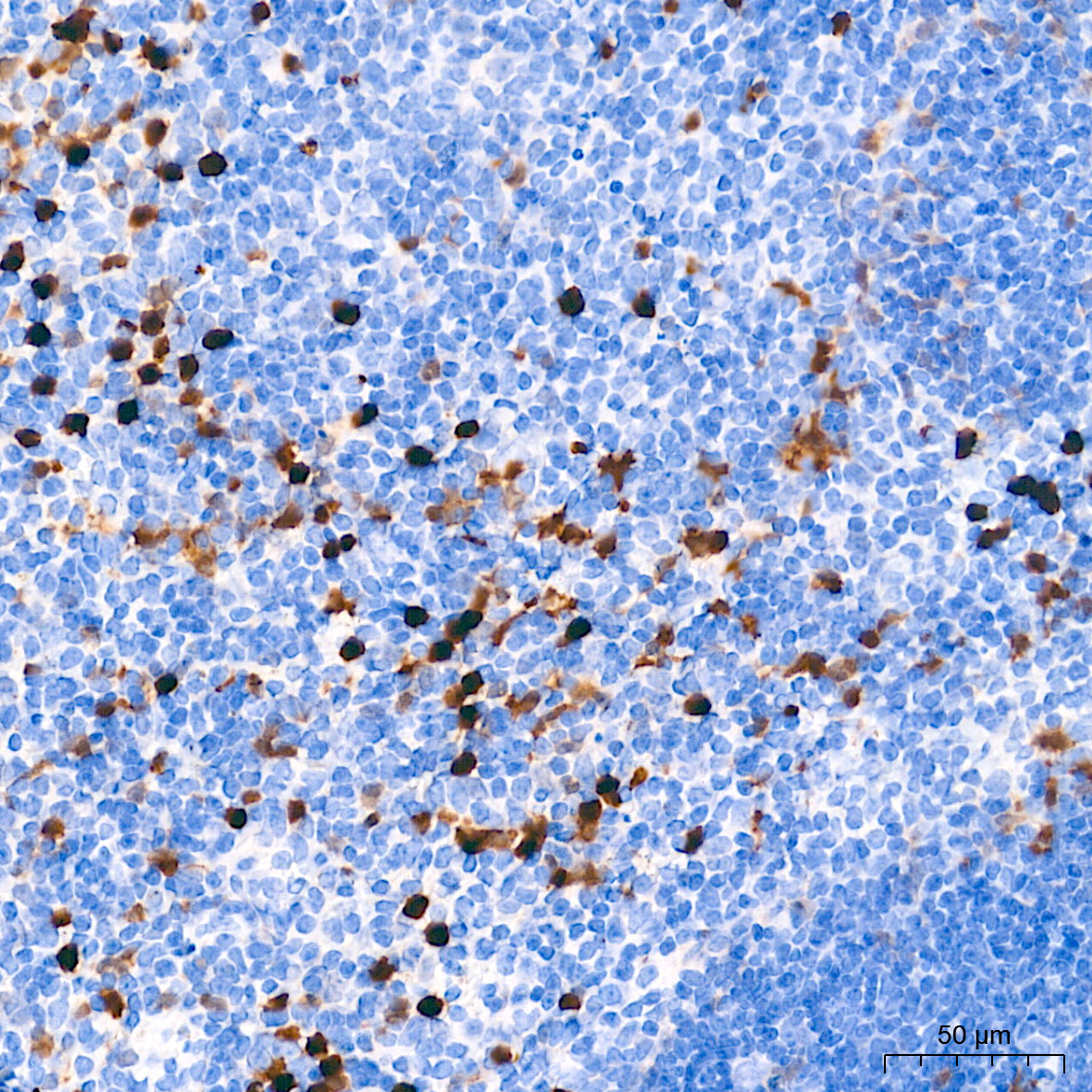 FSP1/S100A4 Rabbit Monoclonal Antibody - Image 7