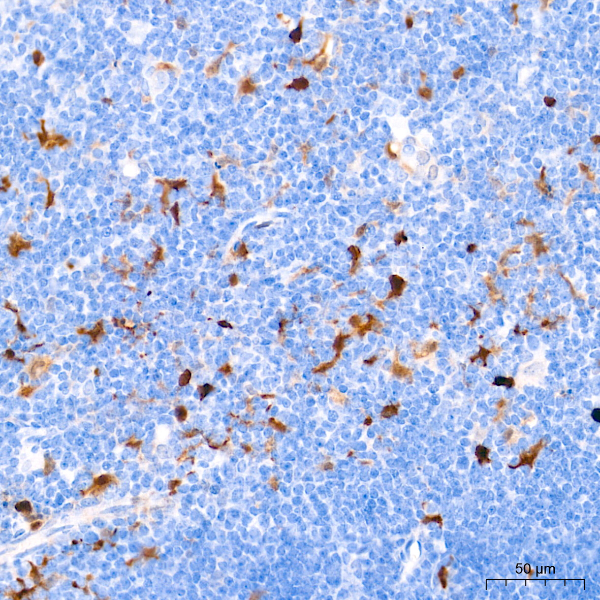 FSP1/S100A4 Rabbit Monoclonal Antibody - Image 8