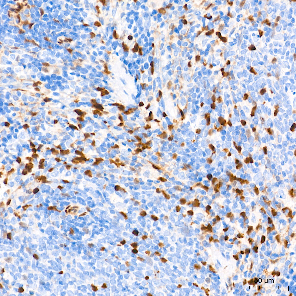 FSP1/S100A4 Rabbit Monoclonal Antibody - Image 9