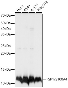 FSP1/S100A4 Rabbit Polyclonal Antibody