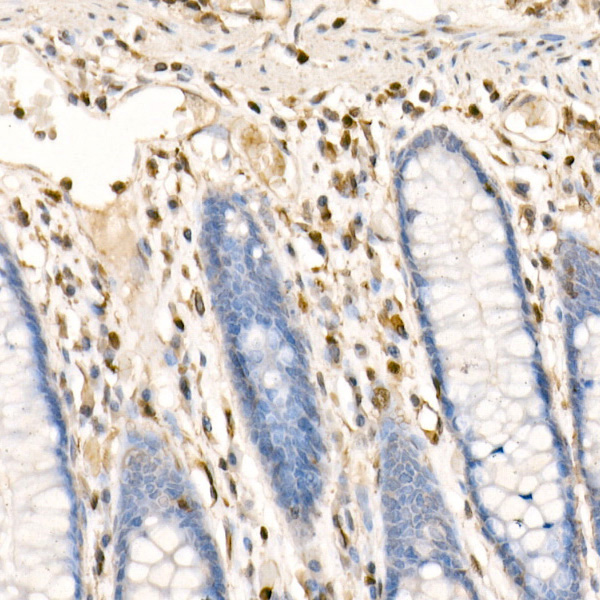FSP1/S100A4 Rabbit Polyclonal Antibody - Image 2