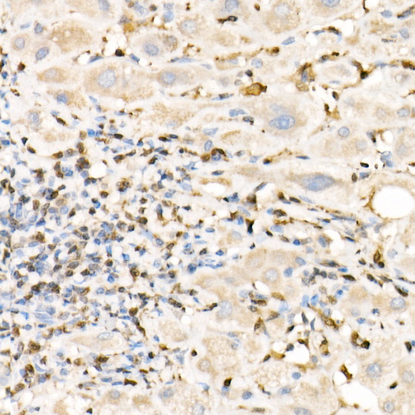 FSP1/S100A4 Rabbit Polyclonal Antibody - Image 3