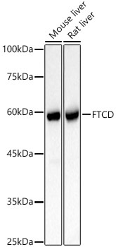 FTCD Rabbit Polyclonal Antibody