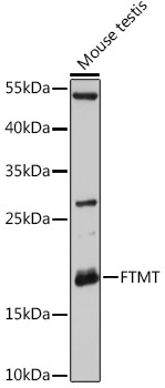 FTMT Rabbit Polyclonal Antibody