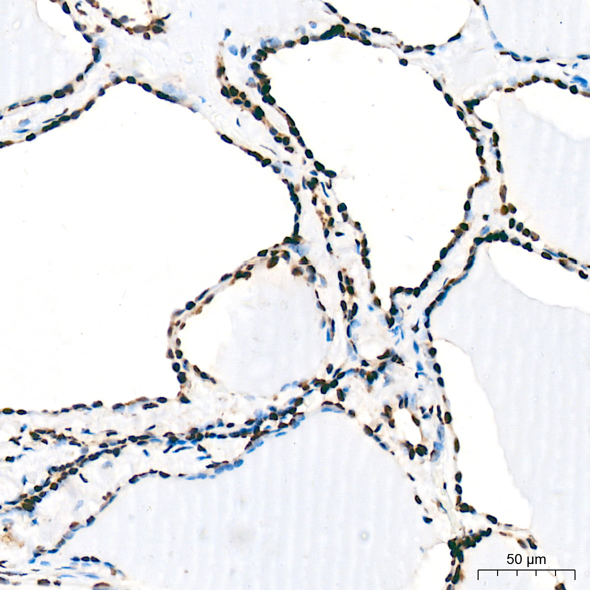 FUBP1 Rabbit Monoclonal Antibody